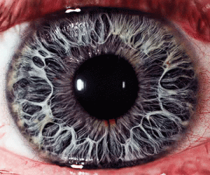 tęczówka oka
